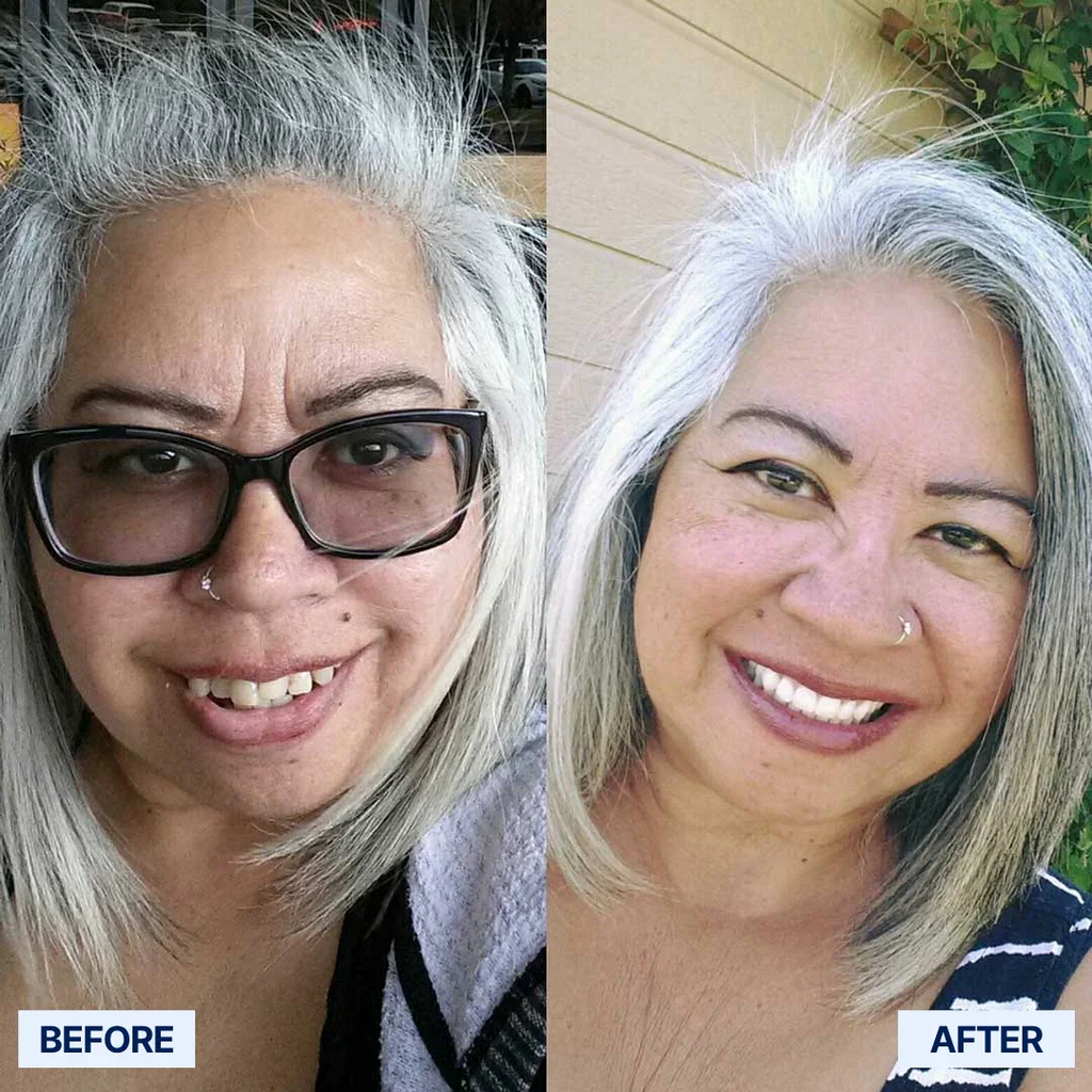 ✅ Advanced Custom-Fit Functional Dentures 🦷 Smile Confidently Again in Just 3 Minutes ❌ No Dentist Needed!