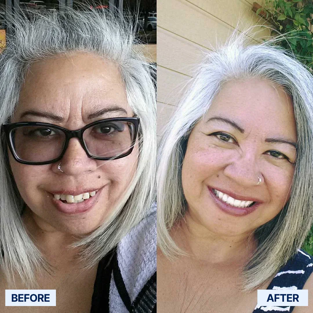 ✅ Advanced Custom-Fit Functional Dentures 🦷 Smile Confidently Again in Just 3 Minutes ❌ No Dentist Needed!