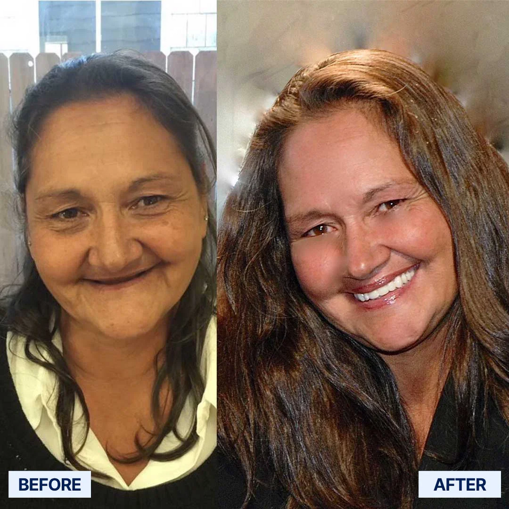 ✅ Advanced Custom-Fit Functional Dentures 🦷 Smile Confidently Again in Just 3 Minutes ❌ No Dentist Needed!